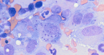 Dog-to-dog transmission of leishmaniosis confirmed