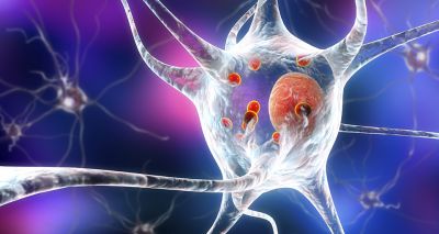 RVC and UCL to pioneer research into Parkinson's