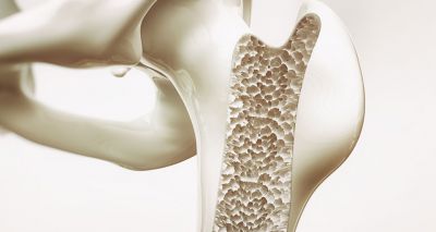 RVC study offers hope for osteoporosis sufferers