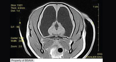 Study reveals gaps in epilepsy guidance compliance